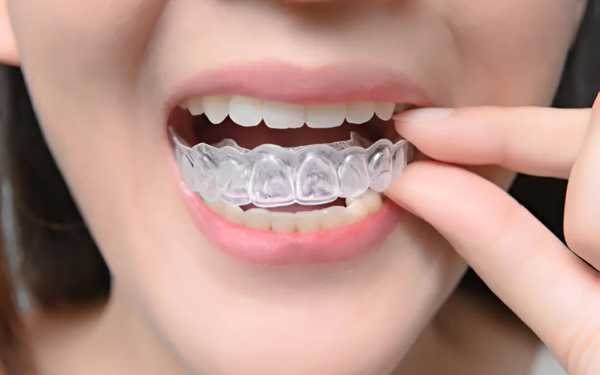 UK Orthodontic Treatments 2025: Finding Affordable & Effective Braces